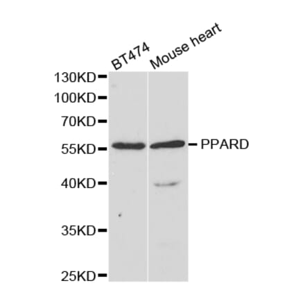 Western blot - PPARD Antibody from Signalway Antibody (32953) - Antibodies.com