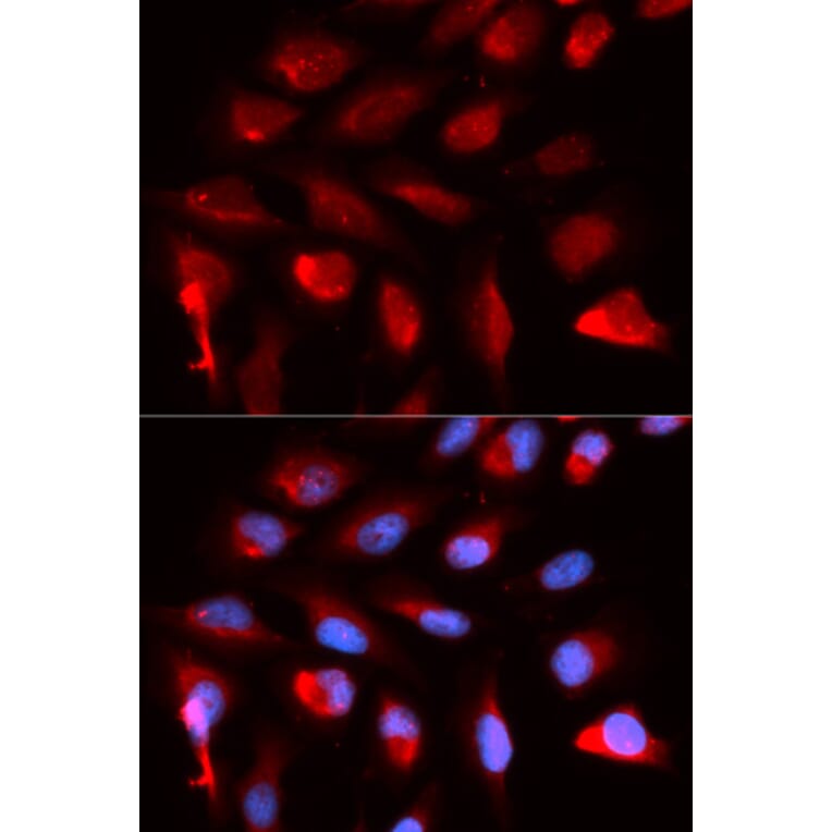 Immunofluorescence - PPARD Antibody from Signalway Antibody (32953) - Antibodies.com