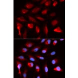 Immunofluorescence - PPARD Antibody from Signalway Antibody (32953) - Antibodies.com