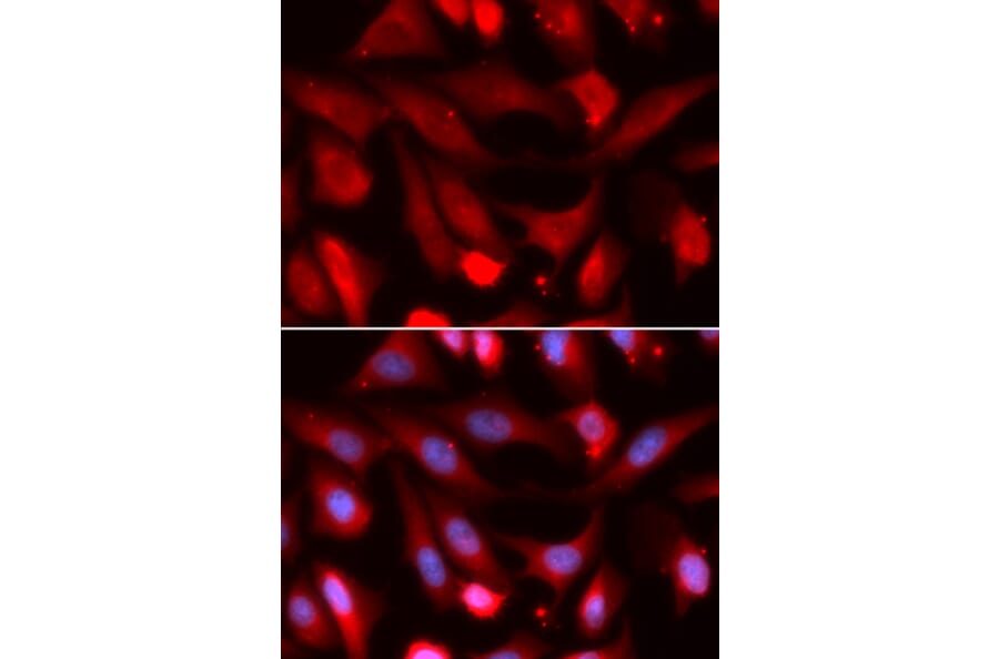 Immunofluorescence - SMAD4 Antibody from Signalway Antibody (32954) - Antibodies.com