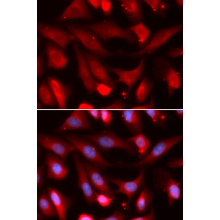 Immunofluorescence - SMAD4 Antibody from Signalway Antibody (32954) - Antibodies.com