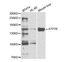 Western blot - ATP7B Antibody from Signalway Antibody (32968) - Antibodies.com