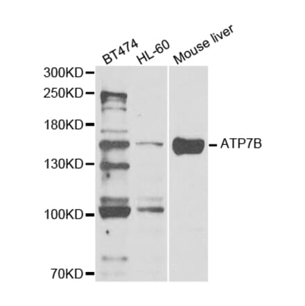 Western blot - ATP7B Antibody from Signalway Antibody (32968) - Antibodies.com