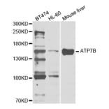 Western blot - ATP7B Antibody from Signalway Antibody (32968) - Antibodies.com