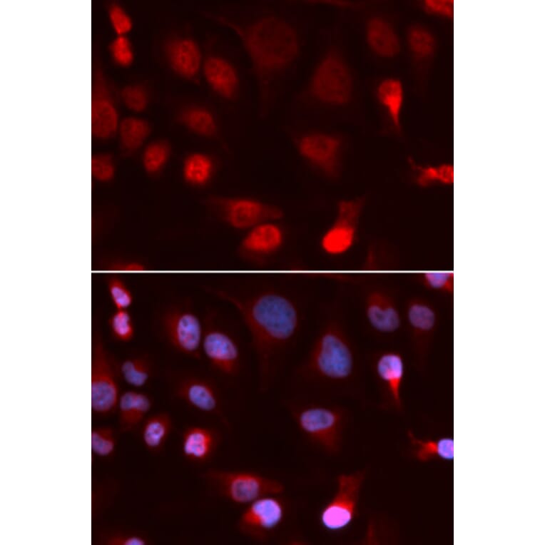 Immunofluorescence - ATP7B Antibody from Signalway Antibody (32968) - Antibodies.com