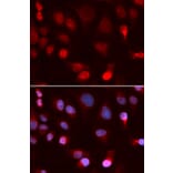 Immunofluorescence - ATP7B Antibody from Signalway Antibody (32968) - Antibodies.com