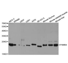 Western blot - PSMB4 Antibody from Signalway Antibody (32983) - Antibodies.com