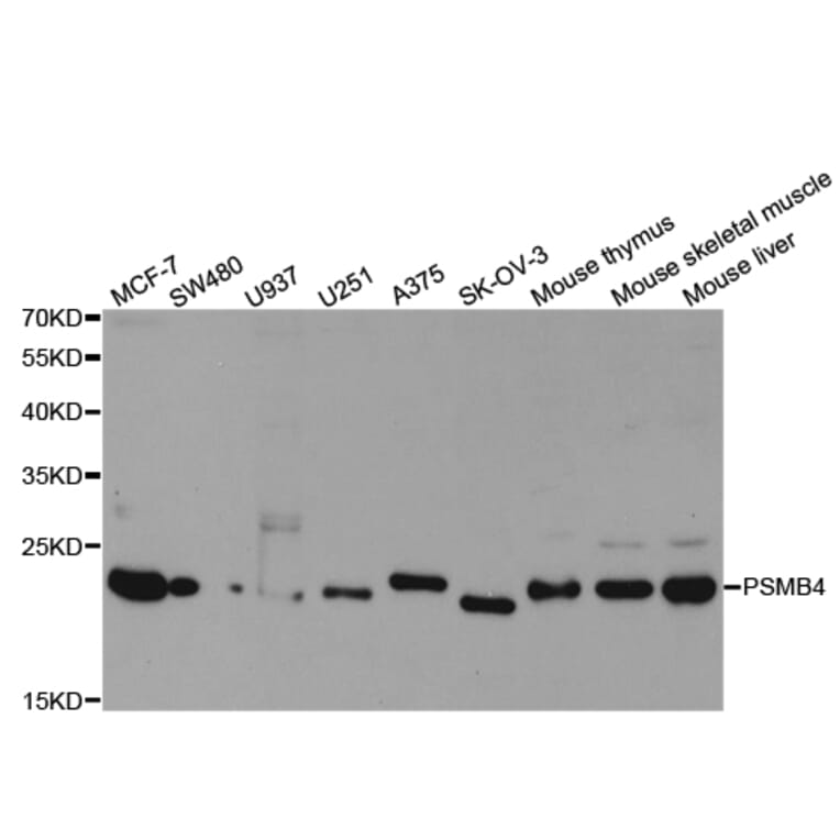 Western blot - PSMB4 Antibody from Signalway Antibody (32983) - Antibodies.com