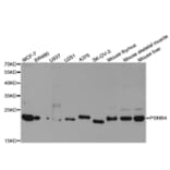 Western blot - PSMB4 Antibody from Signalway Antibody (32983) - Antibodies.com