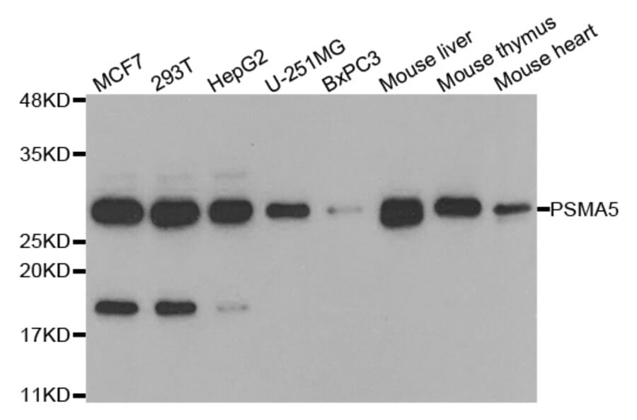 Western blot - PSMA5 Antibody from Signalway Antibody (33017) - Antibodies.com