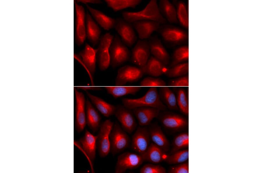 Immunofluorescence - PSMA5 Antibody from Signalway Antibody (33017) - Antibodies.com