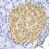 Immunohistochemistry - HTRA2 Antibody from Signalway Antibody (33024) - Antibodies.com