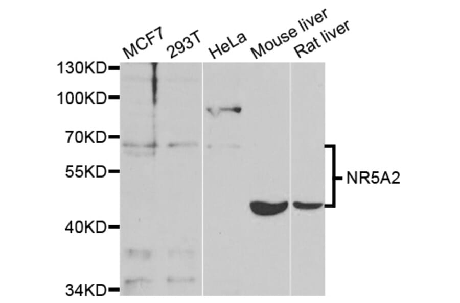 Western blot - NR5A2 Antibody from Signalway Antibody (33028) - Antibodies.com