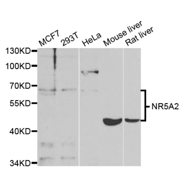 Western blot - NR5A2 Antibody from Signalway Antibody (33028) - Antibodies.com