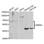 Western blot - NR5A2 Antibody from Signalway Antibody (33028) - Antibodies.com