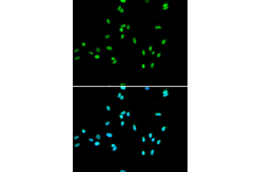 Immunofluorescence - NR5A2 Antibody from Signalway Antibody (33028) - Antibodies.com