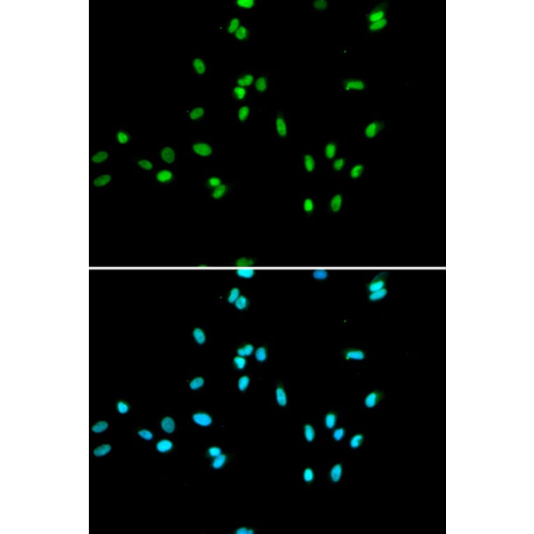 Immunofluorescence - NR5A2 Antibody from Signalway Antibody (33028) - Antibodies.com