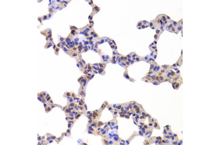 Immunohistochemistry - NR5A2 Antibody from Signalway Antibody (33028) - Antibodies.com