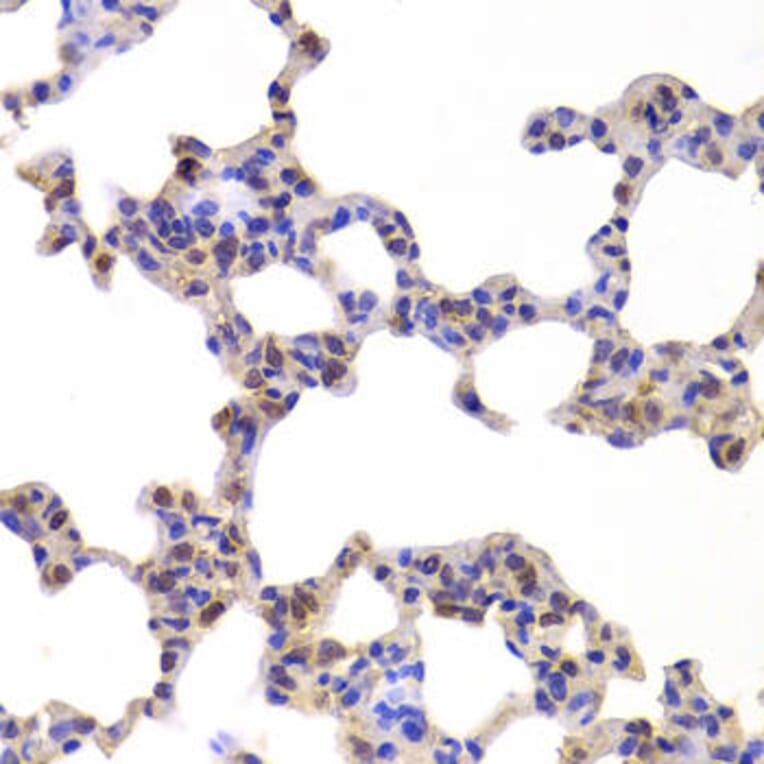Immunohistochemistry - NR5A2 Antibody from Signalway Antibody (33028) - Antibodies.com