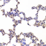 Immunohistochemistry - NR5A2 Antibody from Signalway Antibody (33028) - Antibodies.com