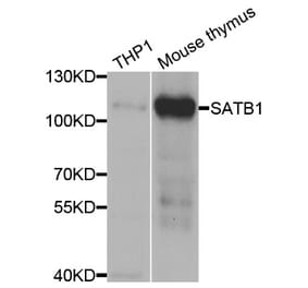 Western blot - SATB1 Antibody from Signalway Antibody (33052) - Antibodies.com