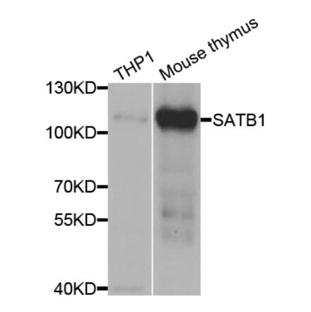 Western blot - SATB1 Antibody from Signalway Antibody (33052) - Antibodies.com