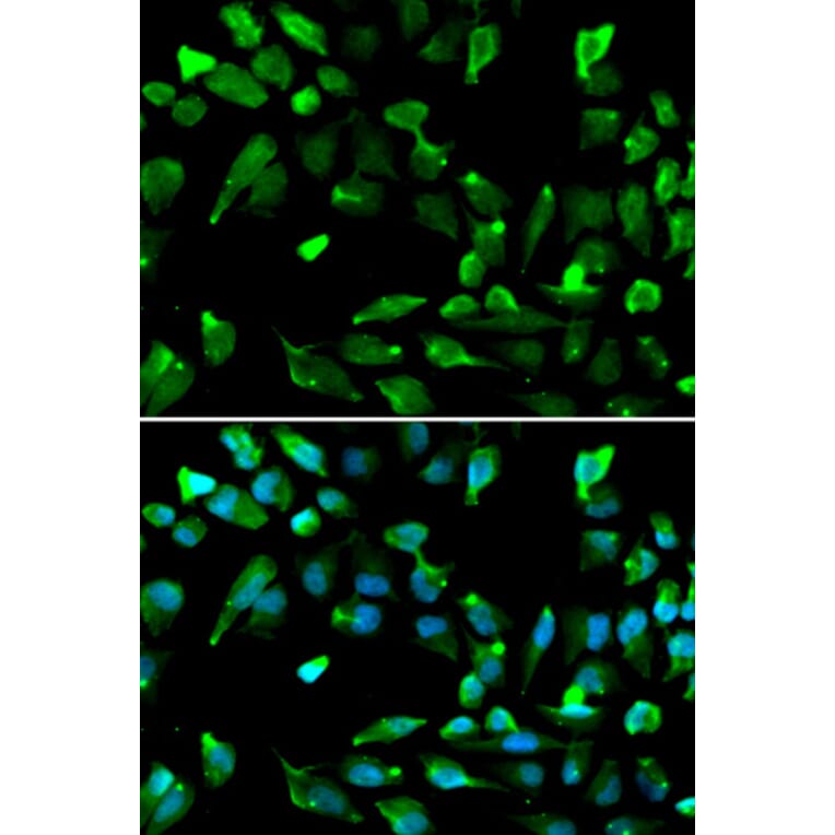 Immunofluorescence - SATB1 Antibody from Signalway Antibody (33052) - Antibodies.com