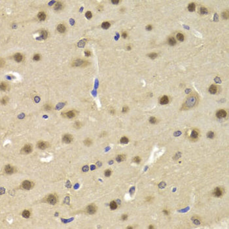 Immunohistochemistry - SATB1 Antibody from Signalway Antibody (33052) - Antibodies.com