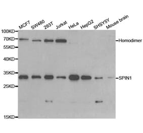 Western blot - SPIN1 Antibody from Signalway Antibody (33091) - Antibodies.com