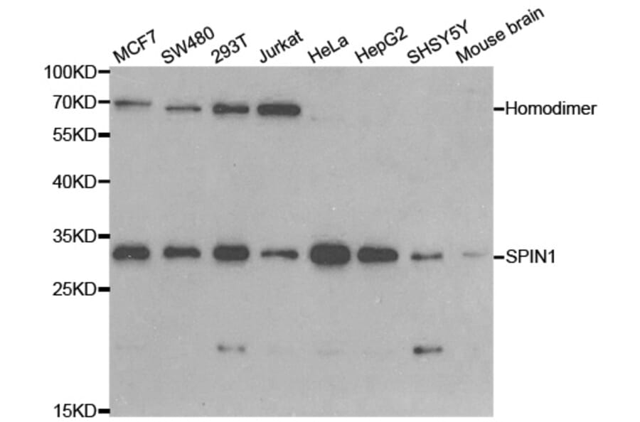 Western blot - SPIN1 Antibody from Signalway Antibody (33091) - Antibodies.com