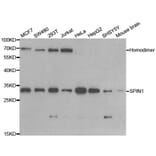 Western blot - SPIN1 Antibody from Signalway Antibody (33091) - Antibodies.com