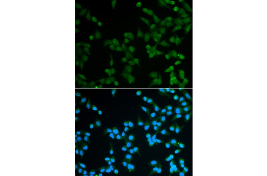 Immunofluorescence - SPIN1 Antibody from Signalway Antibody (33091) - Antibodies.com