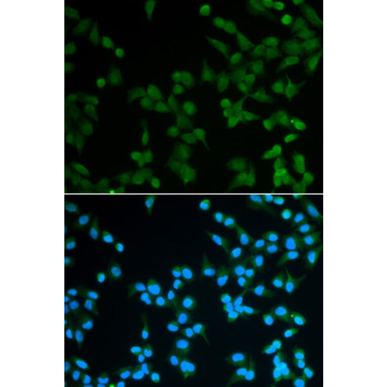 Immunofluorescence - SPIN1 Antibody from Signalway Antibody (33091) - Antibodies.com