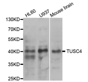 Western blot - NPRL2 Antibody from Signalway Antibody (33096) - Antibodies.com