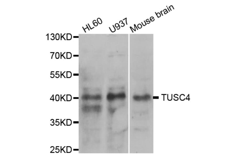 Western blot - NPRL2 Antibody from Signalway Antibody (33096) - Antibodies.com