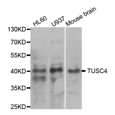 Western blot - NPRL2 Antibody from Signalway Antibody (33096) - Antibodies.com