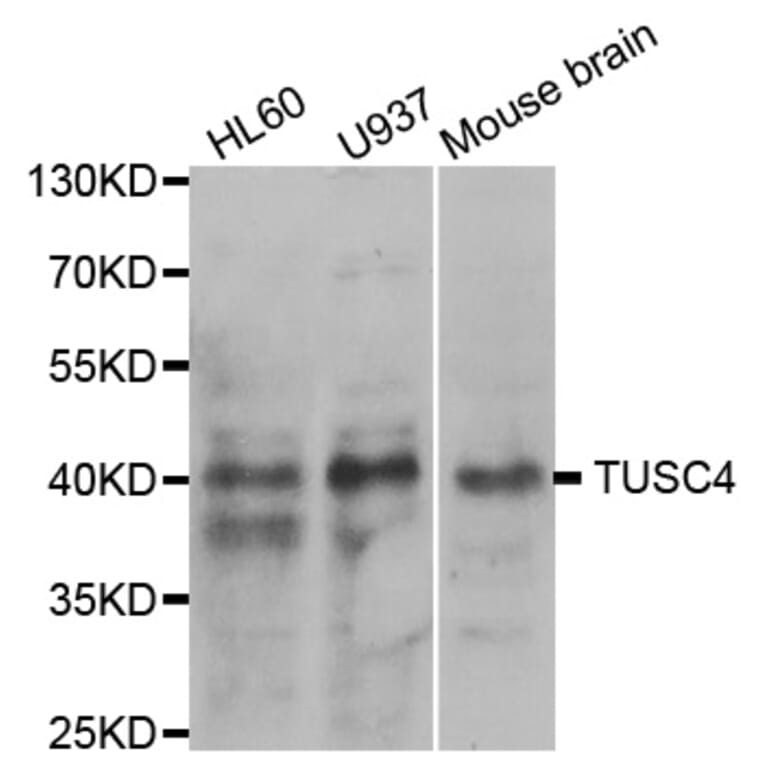 Western blot - NPRL2 Antibody from Signalway Antibody (33096) - Antibodies.com