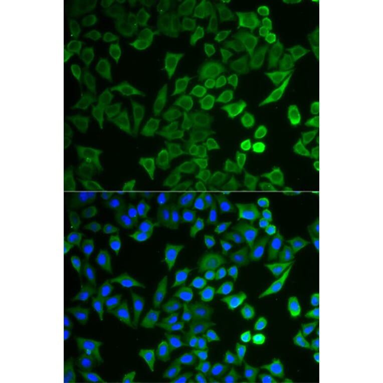 Immunofluorescence - NPRL2 Antibody from Signalway Antibody (33096) - Antibodies.com