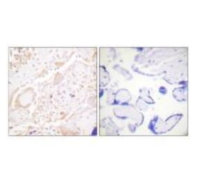Immunohistochemistry - GATA3 Antibody from Signalway Antibody (33160) - Antibodies.com