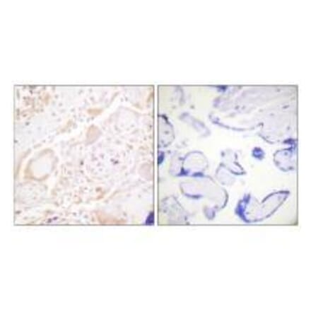 Immunohistochemistry - GATA3 Antibody from Signalway Antibody (33160) - Antibodies.com