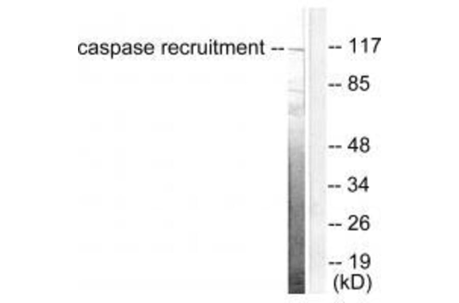 Western blot - CARD6 Antibody from Signalway Antibody (33329) - Antibodies.com