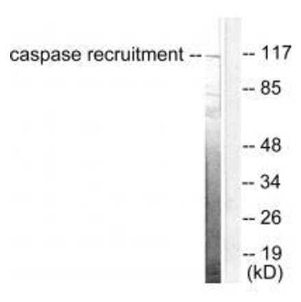 Western blot - CARD6 Antibody from Signalway Antibody (33329) - Antibodies.com