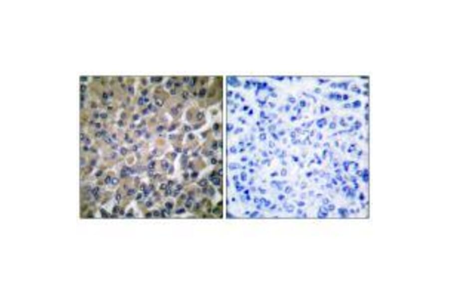 Immunohistochemistry - GRP78 Antibody from Signalway Antibody (33395) - Antibodies.com
