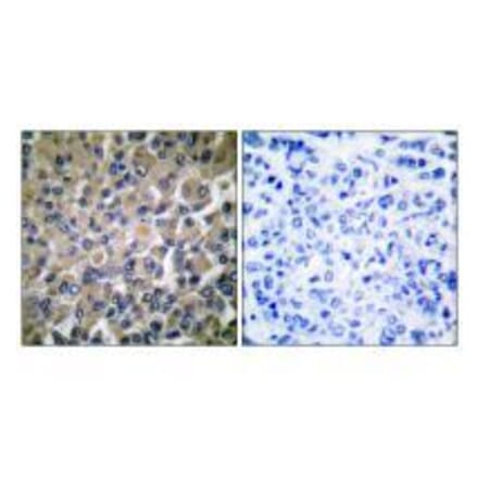 Immunohistochemistry - GRP78 Antibody from Signalway Antibody (33395) - Antibodies.com