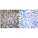 Immunohistochemistry - GRP78 Antibody from Signalway Antibody (33395) - Antibodies.com