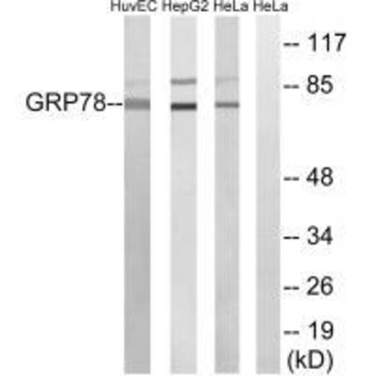 Western blot - GRP78 Antibody from Signalway Antibody (33395) - Antibodies.com