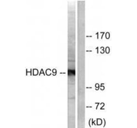 Western blot - HDAC9 Antibody from Signalway Antibody (33403) - Antibodies.com