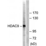 Western blot - HDAC9 Antibody from Signalway Antibody (33403) - Antibodies.com
