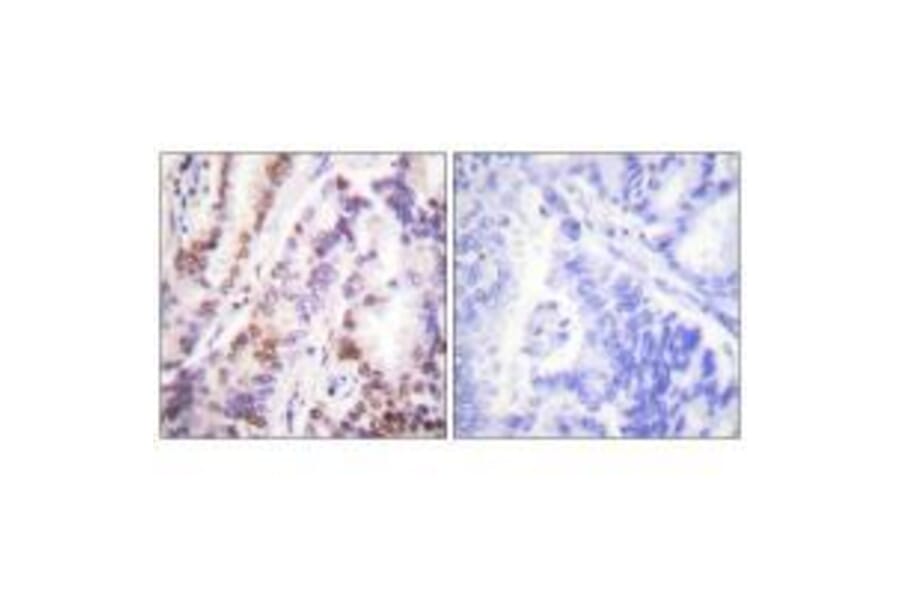 Immunohistochemistry - HDAC9 Antibody from Signalway Antibody (33403) - Antibodies.com
