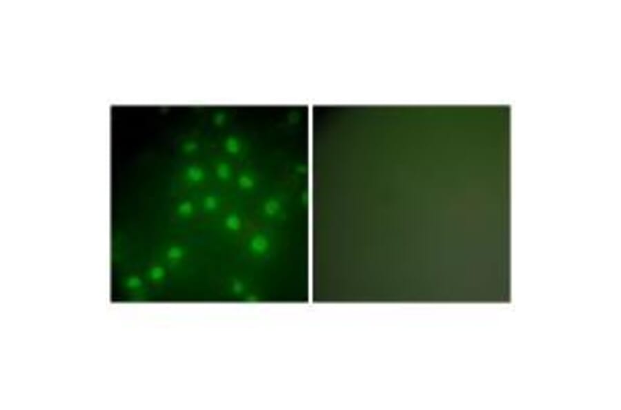 Immunofluorescence - HDAC9 Antibody from Signalway Antibody (33403) - Antibodies.com